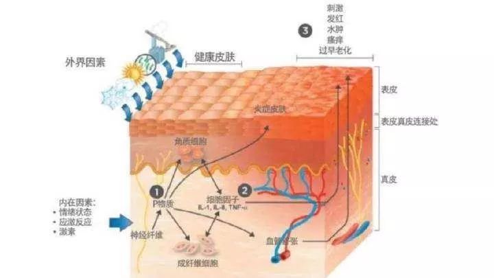 江門市“屏障修復”修復的是什么？不同膚質該如何搭配？